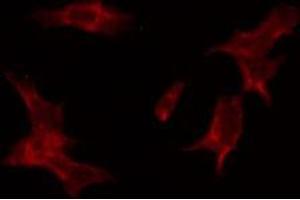 ABIN6274515 staining HuvEc by IF/ICC. (LASS4 antibody  (N-Term))