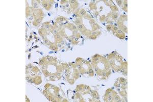 Immunohistochemistry of paraffin-embedded human stomach using SYT4 antibody (ABIN6129135, ABIN6148791, ABIN6148792 and ABIN6223676) at dilution of 1:100 (40x lens). (SYT4 antibody  (AA 38-190))