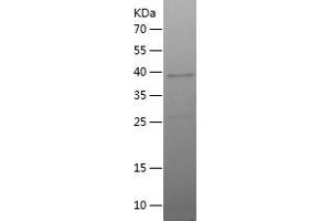 CD236/GYPC Protein (AA 1-128) (His-IF2DI Tag)
