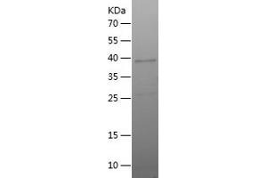 Western Blotting (WB) image for Glycophorin C (GYPC) (AA 1-128) protein (His-IF2DI Tag) (ABIN7123166) (CD236/GYPC Protein (AA 1-128) (His-IF2DI Tag))