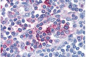 Anti-FPR1 antibody  ABIN1048604 IHC staining of human lymph node.