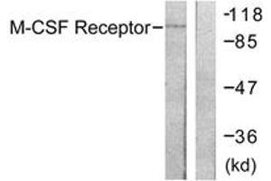 Western blot analysis of extracts from 293 cells, treated with LPS 100ng/ml 30', using M-CSF Receptor (Ab-809) Antibody. (CSF1R antibody  (AA 781-830))