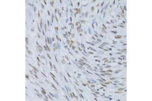 Immunohistochemistry of paraffin-embedded human uterus using SNRNP70 antibody. (SNRNP70 antibody  (AA 150-250))