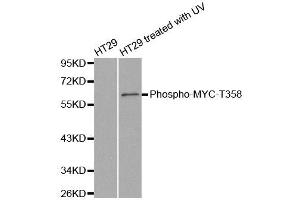 Western blot analysis of extracts from HT29 cells untreated or treated with UV, using phospho-MYC-T358 antibody (ABIN2988193). (c-MYC antibody  (pThr358))