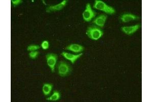 Detection of C1QBP in Hela cells using Polyclonal Antibody to Complement component 1 Q subcomponent-binding protein, mitochondrial (C1QBP) (C1QBP antibody  (AA 76-282))