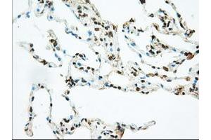 Image no. 7 for anti-Basigin (Ok Blood Group) (BSG) antibody (ABIN1498015) (CD147 antibody)