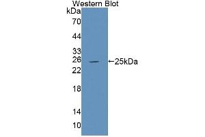 Western blot analysis of the recombinant protein. (PTPRU antibody  (AA 1263-1446))