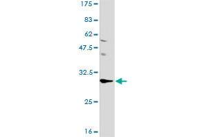 ANP32A monoclonal antibody (M01), clone 2G11-4A5. (PHAP1 antibody  (AA 1-249))