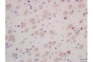 Formalin-fixed and paraffin embedded rat brain labeled with Rabbit Anti-INPPL1 Polyclonal Antibody, Unconjugated (ABIN722200) at 1:200 followed by conjugation to the secondary antibody and DAB staining (INPPL1 antibody  (AA 701-800))