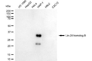 Western blotting analysis using lin-28 homolog B antibody (ABIN7799270). (LIN28B antibody)
