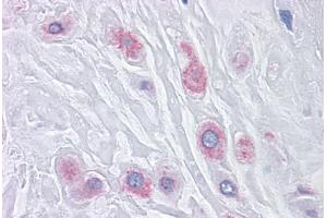 Human Placenta: Formalin-Fixed, Paraffin-Embedded (FFPE) (BUB1B antibody  (AA 1-130))