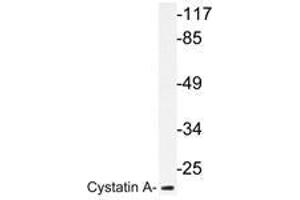 Western blot analysis of Cystatin A antibody in extracts from HT-29 cells. (CSTA antibody)