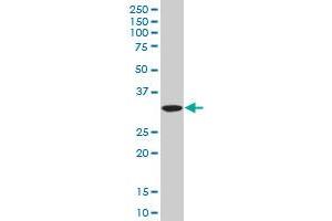 SUMF2 polyclonal antibody (A01), Lot # 060619JCS1 Western Blot analysis of SUMF2 expression in HepG2 .