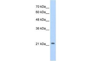 Western Blotting (WB) image for anti-Distal-Less Homeobox Protein 2 (DLX2) antibody (ABIN2460395) (DLX2 antibody)