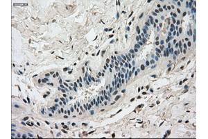 Immunohistochemical staining of paraffin-embedded breast tissue using anti-DHFR mouse monoclonal antibody.