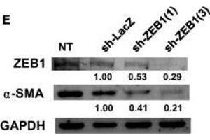 Western Blotting (WB) image for anti-Glyceraldehyde-3-Phosphate Dehydrogenase (GAPDH) antibody (ABIN2857072)