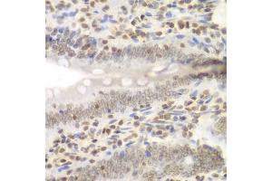 Immunohistochemistry of paraffin-embedded rat Intestine using UHRF2 antibody (ABIN6133264, ABIN6149911, ABIN6149913 and ABIN6217665) at dilution of 1:200 (40x lens). (UHRF2 antibody  (AA 441-622))