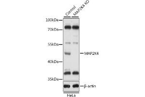 Western blot analysis of extracts from normal (control) and MK4 knockout (KO) HeLa cells, using MK4 antibody (ABIN7268641) at 1:1000 dilution. (MAP2K4 antibody  (AA 300-399))