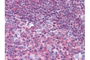 Immunohistochemical analysis of paraffin-embedded human Tonsil tissues using PYK2 mouse mAb. (PTK2B antibody  (AA 815-997))