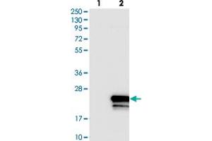 Western blot analysis of Lane 1: Negative control (vector only transfected HEK293T lysate). (SLC51B antibody)