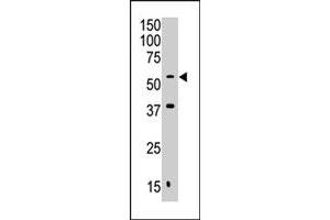 The MAFK polyclonal antibody  is used in Western blot to detect MAFK in Jurkat cell lysate. (Septin 9 antibody  (C-Term))