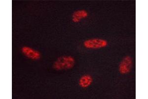 ABIN6267444 staining HUVEC cells by ICC/IF. (GATA3 antibody  (pSer308))