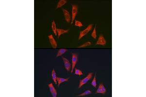 Immunofluorescence analysis of HeLa cells using MYO10 antibody (ABIN6128319, ABIN6144271, ABIN6144274 and ABIN6216113) at dilution of 1:350. (Myosin X antibody  (AA 845-944))