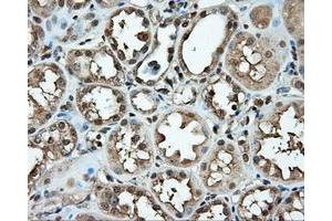 Immunohistochemistry (IHC) image for anti-Induced Myeloid Leukemia Cell Differentiation Protein Mcl-1 (MCL1) antibody (ABIN1499337) (MCL-1 antibody)