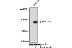 Western blot analysis of extracts of NIH/3T3 cells, using Phospho-Lyn-Y396 Rabbit mAb (ABIN7271269) at 1:1000 dilution. (LYN antibody  (pTyr396))