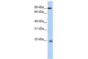 Western Blotting (WB) image for anti-Nuclear Factor of Activated T-Cells, Cytoplasmic, Calcineurin-Dependent 1 (NFATC1) (N-Term) antibody (ABIN2780747)