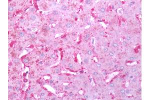 Human Liver: Formalin-Fixed, Paraffin-Embedded (FFPE) (FPR2 antibody  (C-Term))