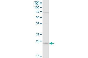 IL21 MaxPab rabbit polyclonal antibody. (IL-21 antibody  (AA 1-162))