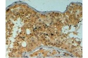 Immunohistochemistry (Paraffin-embedded Sections) (IHC (p)) image for anti-Piwi-Like 1 (PIWIL1) (Internal Region) antibody (ABIN1108654) (PIWIL1 antibody  (Internal Region))