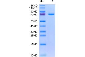 GAS6 Protein (AA 49-678) (His tag)