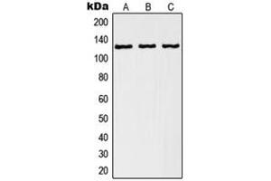 Western blot analysis of RANBP6 expression in A549 (A), K562 (B), human kidney (C) whole cell lysates. (RANBP6 antibody  (Center))