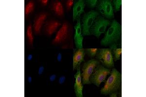 ABIN6261136 and ABIN6272575 staining  cells by IF/ICC.