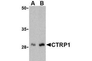 Western blot analysis of CTRP1 in human kidney cell lysate with AP30247PU-N CTRP1 antibody at (A) 1 and (B) 2 μg/ml.