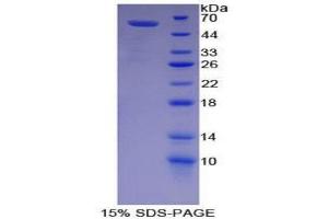 SDS-PAGE (SDS) image for Lipase, Hepatic (LIPC) (AA 103-356) protein (His tag,GST tag) (ABIN2123170)