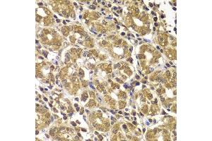 Immunohistochemistry of paraffin-embedded human gastric using HSPE1 antibody. (HSPE1 antibody  (AA 1-102))