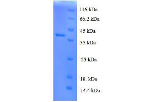 Protein expressed in E. (IL-8 Protein (AA 23-101, full length) (His tag))