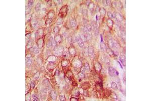Immunohistochemistry (IHC) image for anti-serpin Peptidase Inhibitor, Clade B (Ovalbumin), Member 5 (SERPINB5) (Center) antibody (ABIN7296588)
