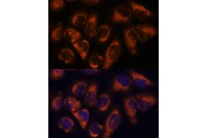 Immunofluorescence analysis of HeLa cells using NDRG4 antibody  at dilution of 1:100.