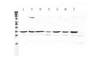 Western blot analysis of UCP2 using anti-UCP2 antibody .