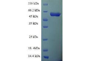 SDS-PAGE (SDS) image for Scribbled Homolog (SCRIB) (AA 33-443) protein (His-SUMO Tag) (ABIN5711627) (SCRIB Protein (AA 33-443) (His-SUMO Tag))