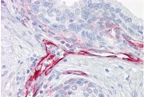 Anti-Vimentin antibody IHC staining of human prostate. (Vimentin antibody)
