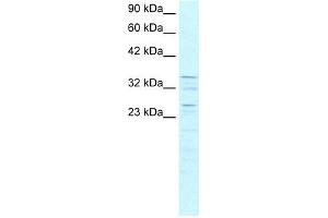 WB Suggested Anti-ZNF385 Antibody Titration: 0. (ZNF385A antibody  (C-Term))