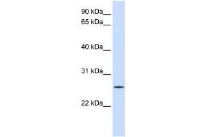 WB Suggested Anti-UNC50 Antibody Titration:  0. (UNC50 antibody  (N-Term))