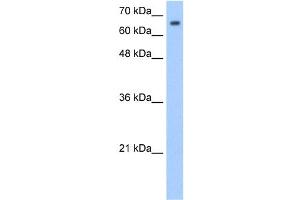 WB Suggested Anti-SYVN1 Antibody Titration:  1. (SYVN1 antibody  (Middle Region))
