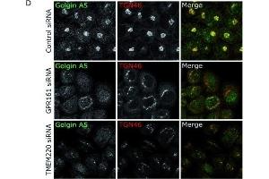 Immunofluorescence (Cultured Cells) (IF (cc)) image for anti-Golgin A5 (GOLGA5) antibody (ABIN2855796)