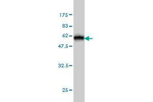 Western Blot detection against Immunogen (52. (MTUS1 antibody  (AA 1-240))